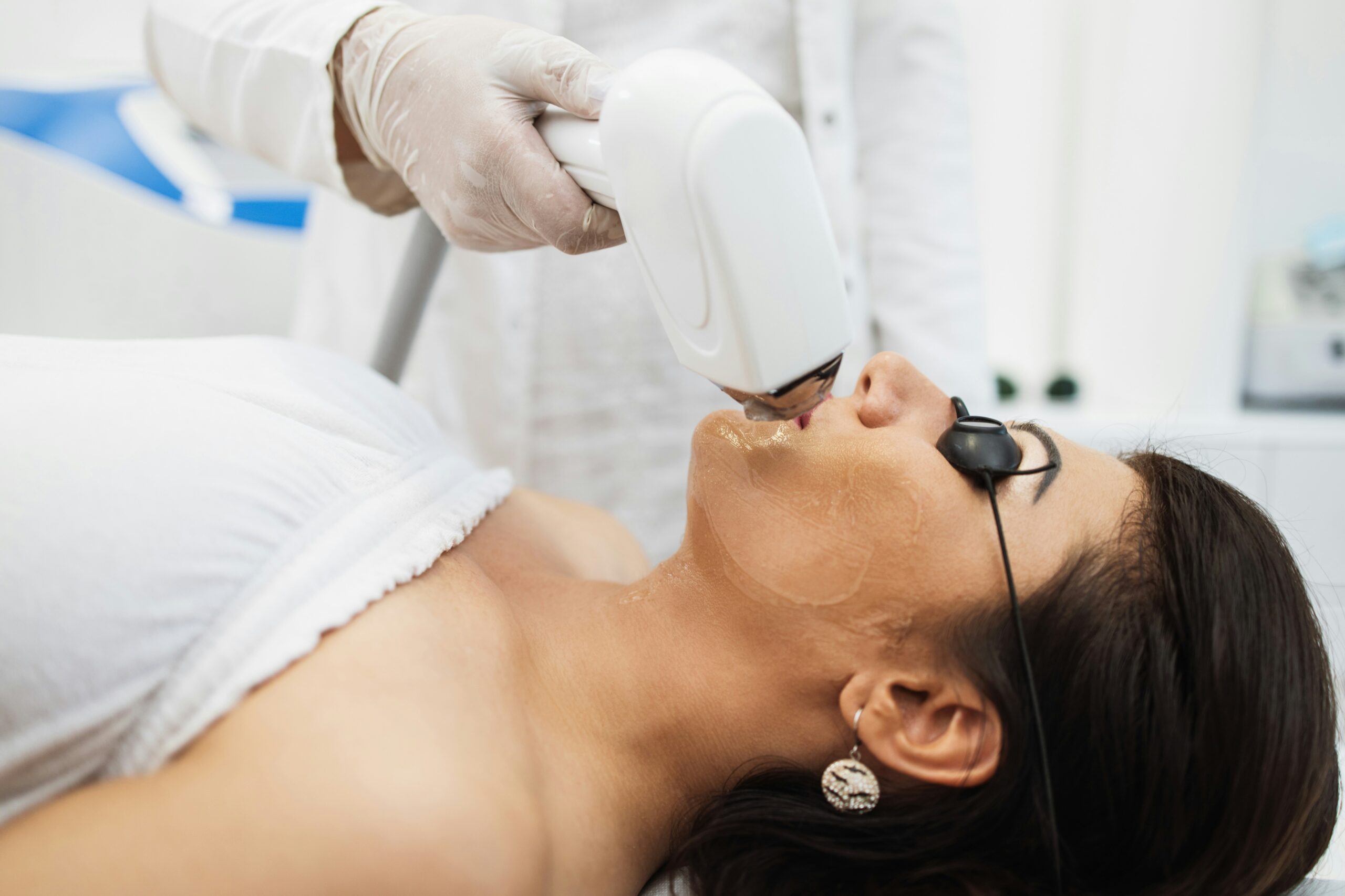 Laser skin resurfacing treatment improving skin tone and texture